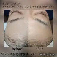 【女性】ブラジリアンワックス(VIO)+フェイシャルワックス