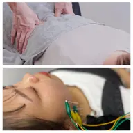美容鍼+姿勢改善