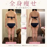 ✨【結果重視】痩せタイプ分析付✨7工程全身痩身90分🌻むくみ・肩こり・セルライト・ボディラインを徹底ケア💛¥3980