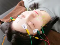 『ミニモ学割U24』成人前にも🙆♂️本格美容鍼+電気パルス🪡