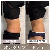 【痩身】エステ版オンダリフトBODY1箇所 【お腹・二の腕・腰・おしり・太もも(表or裏)】