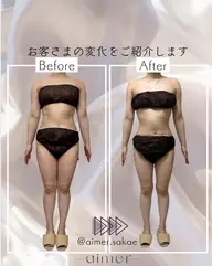 全身痩身:脂肪&セルライトを溶かして流すハイパーナイフEX+リンパマッサージ60分