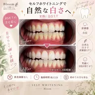 セルフホワイトニング🦷 🕒ご予約枠10:00/12:00/14:00