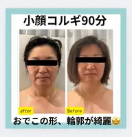 食いしばり・首肩こりから整える小顔コルギ90分
