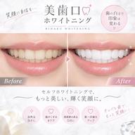 オーラルケア　セルフホワイトニング(スタンダード)
