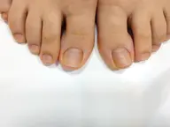 フットネイルケア(オフ込)