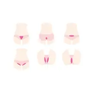 女性VIO脱毛4箇所セット