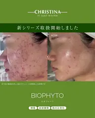 【モニター価格】クリスティーナ ビオフィート｜毛穴・くすみケア