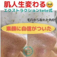 艶肌プレミアムコース