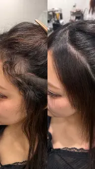 顔まわりの美髪矯正