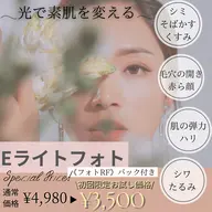 Eライトフェイシャル♡