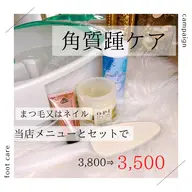 角質ケアセット料金
