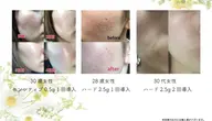剥離ありハーブピーリング&保湿パック🌿ソフト