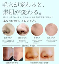 韓国式🇰🇷毛穴洗浄✨✨鏡を見る度に気になる毛穴、、、毛穴洗浄で綺麗サッパリ毛穴のお悩みとおさらばしてみませんか?