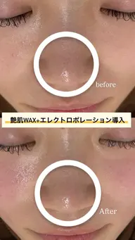 艶肌WAX®＋美容液導入ケア✨｜毛穴汚れ・乾燥・ツヤ