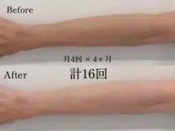 【逆日サロ⁉︎透明感取り戻し作戦】