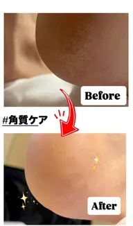 足の角質ケア🦶🏻✨️
