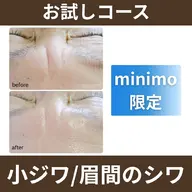 【お試し】ハーブピーリング