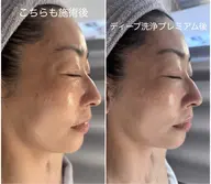 【平成生まれ限定】押し出さないのにつるん✨毛穴ディープ洗浄プレミアム