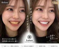【就活中やお仕事されてる方オススメ♪集中40分照射◎】