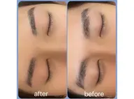 美眉WAX脱毛✨️