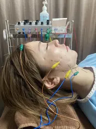 電気美容鍼