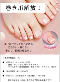 巻爪解放&爪ケア(足浴&マッサージ付き)