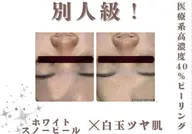 9月限定💗初めての方お勧め💗✨20代後半からの肌メンテ✨フェイシャルエステ45分￥4500