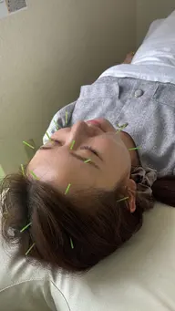🌿美容鍼　ミニモ学割🏵️