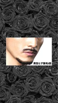 men'sヒゲ🧔🏻‍♂️脱毛1回