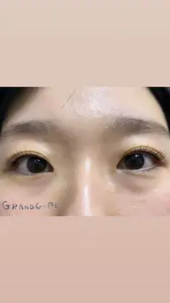ヴィーガンラッシュリフト