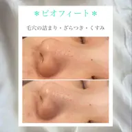 今人気のハーブピーリング🌿剥離なし✨クリスティーナ【ビオフィート】💁♀️💕