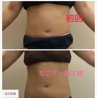 ミラクルウェーブ(おなか周り)+コラーゲンマシン40分