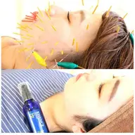 【初回】プラチナムコース◇美容鍼+ハーバルピーリング(カウンセリング込み)