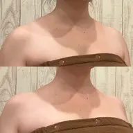 【贅沢フルコース体験👑】小顔矯正+筋膜ラジオ波+脂肪デトックス🔥《デコルテ肩首凝り/エラ張り/顎関節症/眼精疲労》