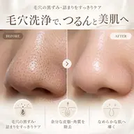 【本気で美肌を目指す方へ✨】水光肌実感◎韓国美肌に🫧毛穴スッキリ洗浄体験〈90分〉¥0