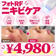 【徹底ニキビケア✨】結果を出したい方へ!フォトRF肌質改善・ニキビ・跡解消 ¥4,980