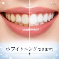 美容セルフホワイトニング 初回限定