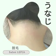 うなじ脱毛 シェービング込み ¥2200円