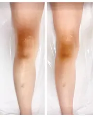 気になる部位を集中ケア⭐︎  深部まで温め＋特殊な超音波＋燃焼マッサージの60分