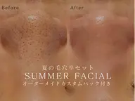 【7月限定】夏の毛穴リセットフェイシャル🌞オーダーメイドカスタムパック付 毛穴洗浄‪×美容液導入🫧