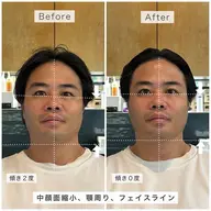 【6・7月限定】ととのう小顔 骨格補正スパ💆🏻♀️🫧 ※S.B込み