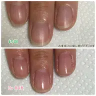【隠す爪から魅せる爪に✨】育成ケアお試しコース🫶ෆ.*・゚