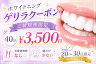 【ご新規様限定・月末限定】ゲリラクーポン40分¥3,500!白い歯応援キャンペーン!