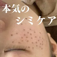 【本気の集中シミ改善】最新シミケア+超音波毛穴洗浄+プラセンタ美容液導入付+リフトアップ