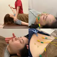 美容鍼（百華鍼）+鍼灸施術+矯正メニュー
