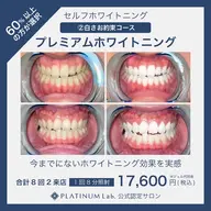人気No.1⭐️⭐️⭐️歯科連携で真っ白に！プレミアムホワイトニング🦷（計2来店70分照射）