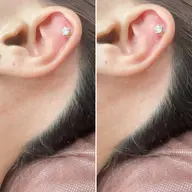 うなじWax脱毛