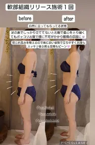 軟部組織リリース120分
