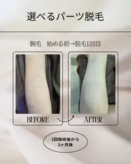 【レディース・メンズok】選べる3箇所！気になる部位のお好みパーツ脱毛